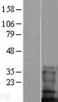 ls055273 tmem100 human over expression lysates nm 001099640 wb testing 1