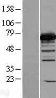 PGM2 Human Over-expression Lysates NM_018290