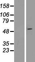 ZNF654 Human Over-expression Lysates NM_018293