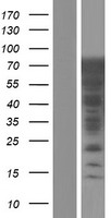 ls055282 lrrc36 human over expression lysates nm 001161575 wb testing 2