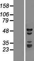 ls055285 rbm41 human over expression lysates nm 018301 wb testing 1