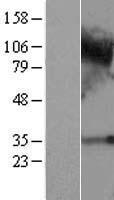C4orf19 Human Over-expression Lysates NM_018302