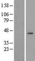 UEVLD Human Over-expression Lysates NM_018314