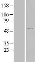 TBC1D19 Human Over-expression Lysates NM_018317
