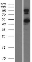 CCDC91 Human Over-expression Lysates NM_018318