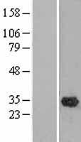 OLAH Human Over-expression Lysates NM_001039702