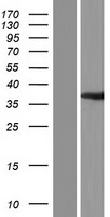 OLAH Human Over-expression Lysates NM_018324