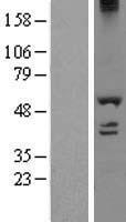 DDX19A Human Over-expression Lysates NM_018332