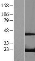 RFK Human Over-expression Lysates NM_018339