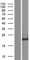 CSTP1 (CPPED1) Human Over-expression Lysates NM_001099455