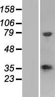 CSTP1 (CPPED1) Human Over-expression Lysates NM_018340