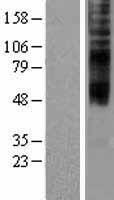 ls055314 tmem144 human over expression lysates nm 018342 wb testing 1