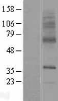 SLC29A3 Human Over-expression Lysates NM_018344