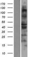 RSAD1 Human Over-expression Lysates NM_018346