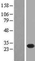TMA16 Human Over-expression Lysates NM_018352