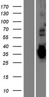 ls055321 tmem74b human over expression lysates nm 018354 wb testing 1