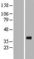 Renalase (RNLS) Human Over-expression Lysates NM_018363