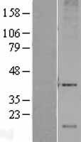 ls055332 dram dram1 human over expression lysates nm 018370 wb testing 1