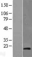 SYNJ2BP Human Over-expression Lysates NM_018373