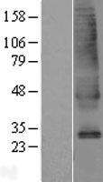 ls055334 slc39a9 human over expression lysates nm 018375 wb testing 1