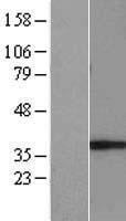 GIMAP5 Human Over-expression Lysates NM_018384