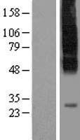 SLC35C1 Human Over-expression Lysates NM_018389