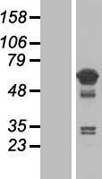 TCP11L1 Human Over-expression Lysates NM_001145541