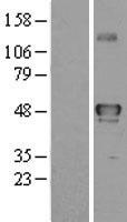 YANK2 (STK32B) Human Over-expression Lysates NM_018401