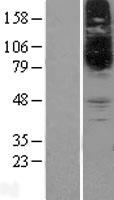 ls055356 slc22a15 human over expression lysates nm 018420 wb testing 1