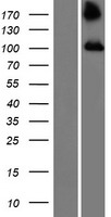 TBC1D2 Human Over-expression Lysates NM_018421