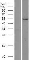 PI4K2A Human Over-expression Lysates NM_018425