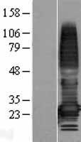 TMEM176A Human Over-expression Lysates NM_018487