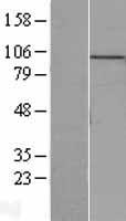MCM10 Human Over-expression Lysates NM_018518
