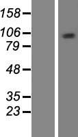 MCM10 Human Over-expression Lysates NM_182751