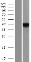 YOD1 Human Over-expression Lysates NM_018566