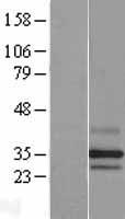 PARL Human Over-expression Lysates NM_018622