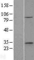 ethanolamine kinase (ETNK1) Human Over-expression Lysates NM_001039481