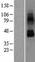 TRPV6 Human Over-expression Lysates NM_018646