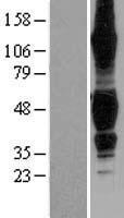 TROY (TNFRSF19) Human Over-expression Lysates NM_018647