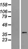 ls055508 slc35e3 human over expression lysates nm 018656 wb testing 1