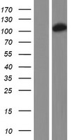 DHTKD1 Human Over-expression Lysates NM_018706