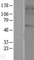 SVOP Human Over-expression Lysates NM_018711