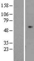 CDCA7L Human Over-expression Lysates NM_018719