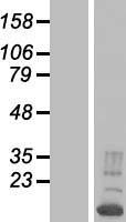 RBM38 Human Over-expression Lysates NM_183425