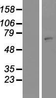 HSZFP36 (ZNF823) Human Over-expression Lysates NM_001080493
