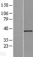 UCHL5IP (HAUS7) Human Over-expression Lysates NM_017518