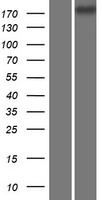 CDC42BPG Human Over-expression Lysates NM_017525