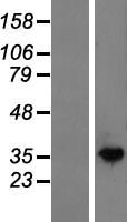 N acetylglucosamine kinase (NAGK) Human Over-expression Lysates NM_017567
