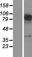 FAM48A (SUPT20H) Human Over-expression Lysates NM_001014286