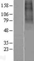 CHRNA9 Human Over-expression Lysates NM_017581